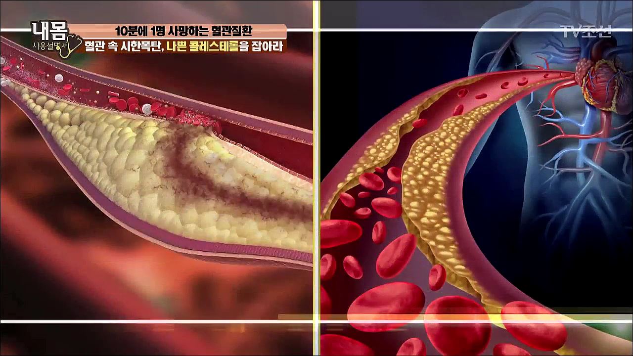 내 몸 사용 설명서 151회