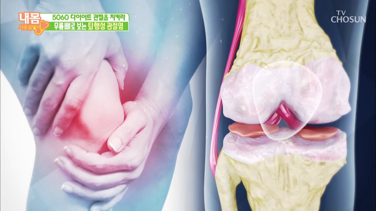 내 몸 사용 설명서 257회