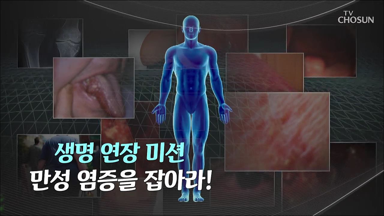 특집다큐 42회 - 생명연장 미션 세포 건강을 지켜라