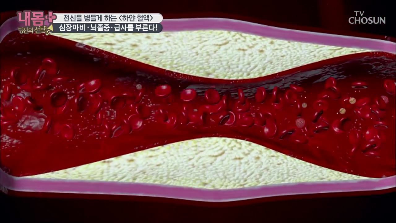 내 몸 플러스 157회 