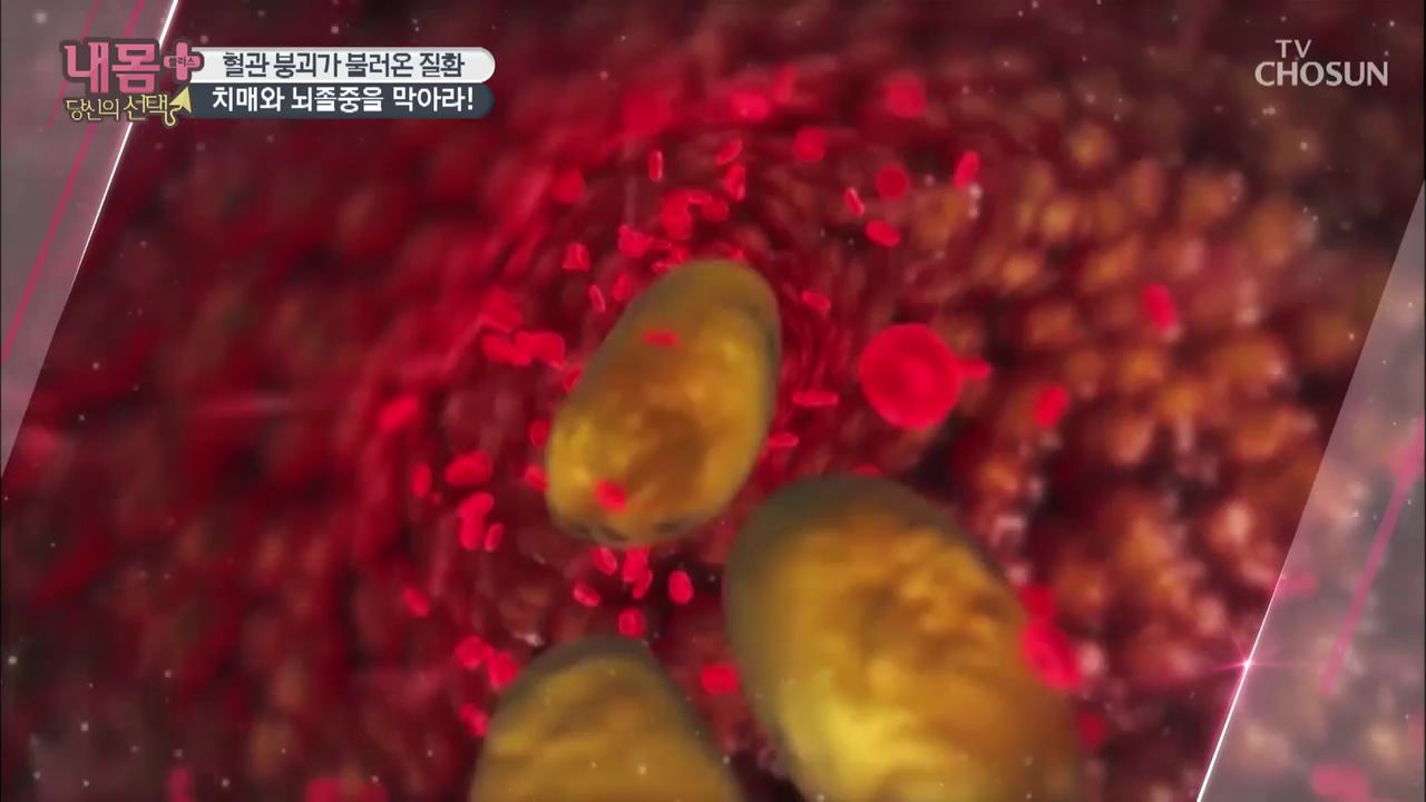 내 몸 플러스 160회