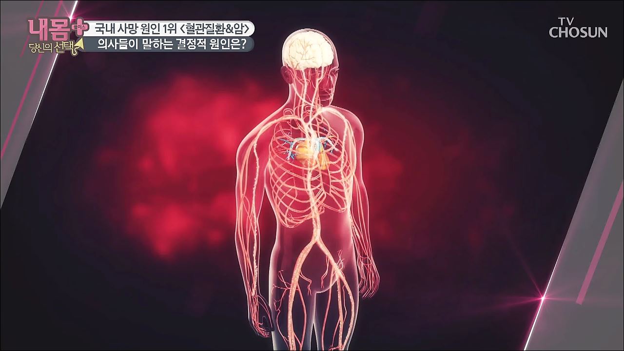 내 몸 플러스 161회