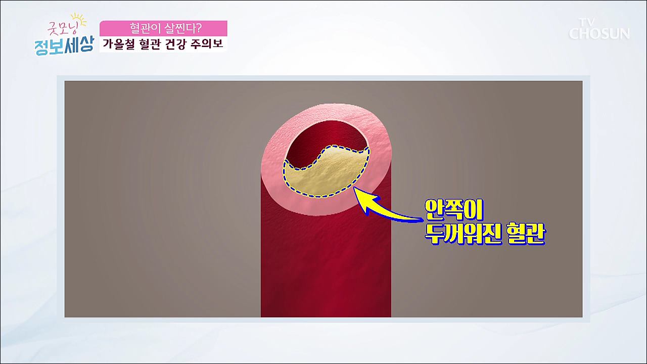 굿모닝 정보세상 85회 