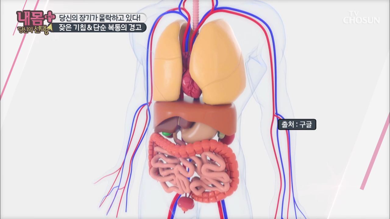 내 몸 플러스 171회