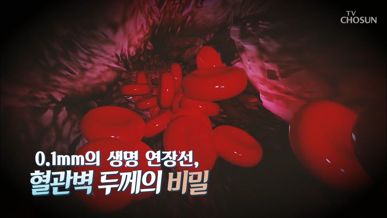 건강다큐 64회 - 0.1mm의 생명 연장선, 혈관벽 두께의 비밀