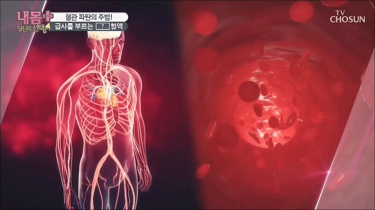 내 몸 플러스 173회  