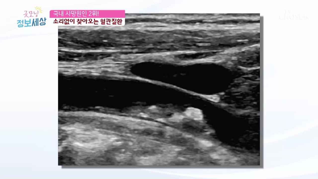 굿모닝 정보세상 129회