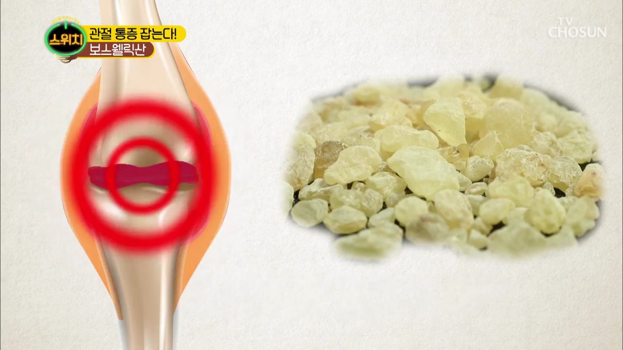 스위치 25회