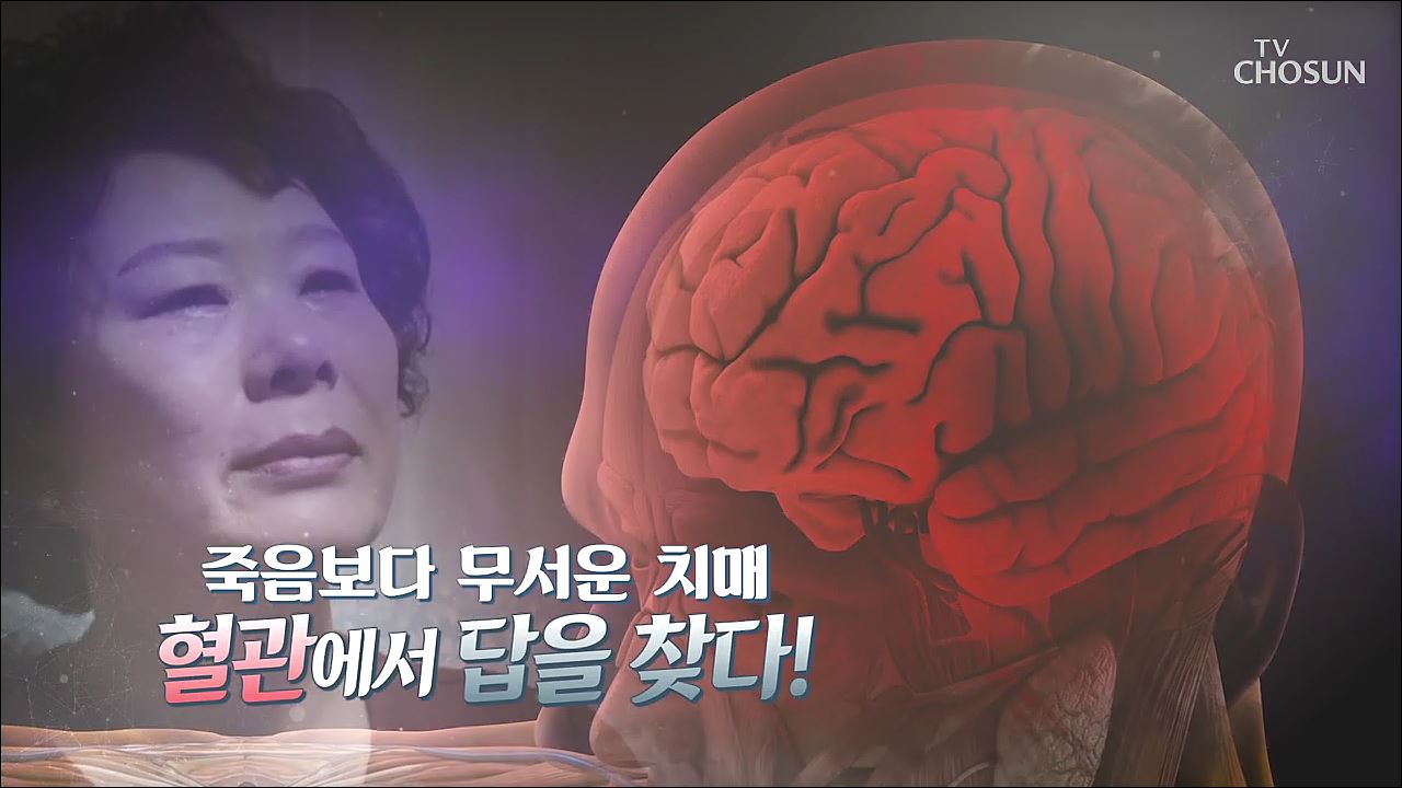 건강다큐 70회 - 죽음보다 무서운 치매 혈관에서 답을 찾다!