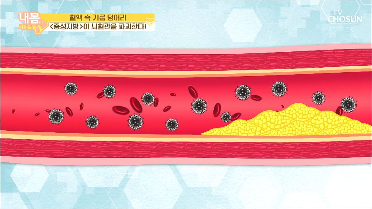 내 몸 사용 설명서 293회