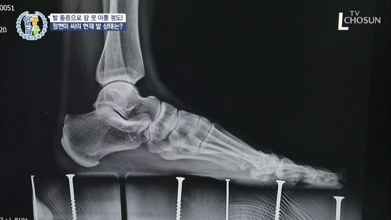알콩달콩 26회
