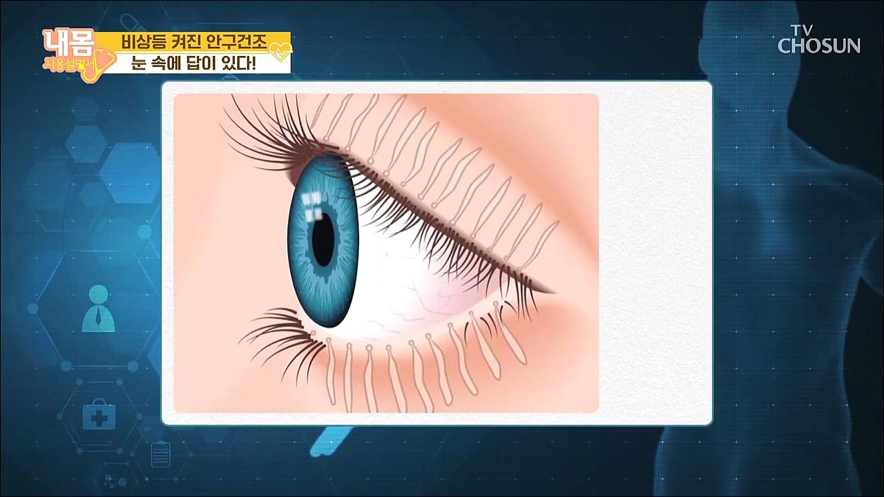 내 몸 사용 설명서 301회