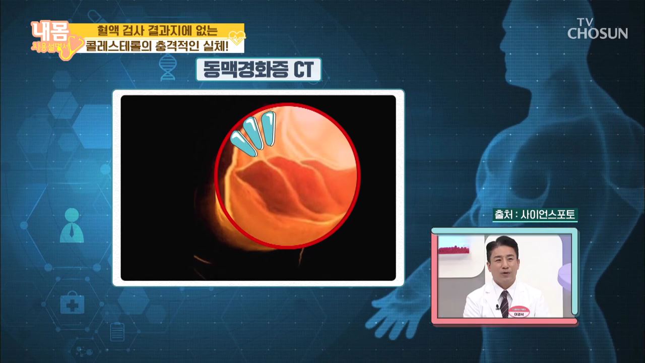 내 몸 사용 설명서 302회