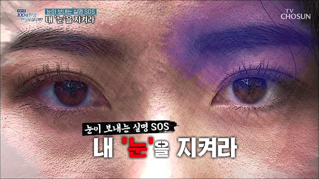 건강다큐 87회 - 눈이 보내는 실명, SOS 내 '눈'을 지켜라