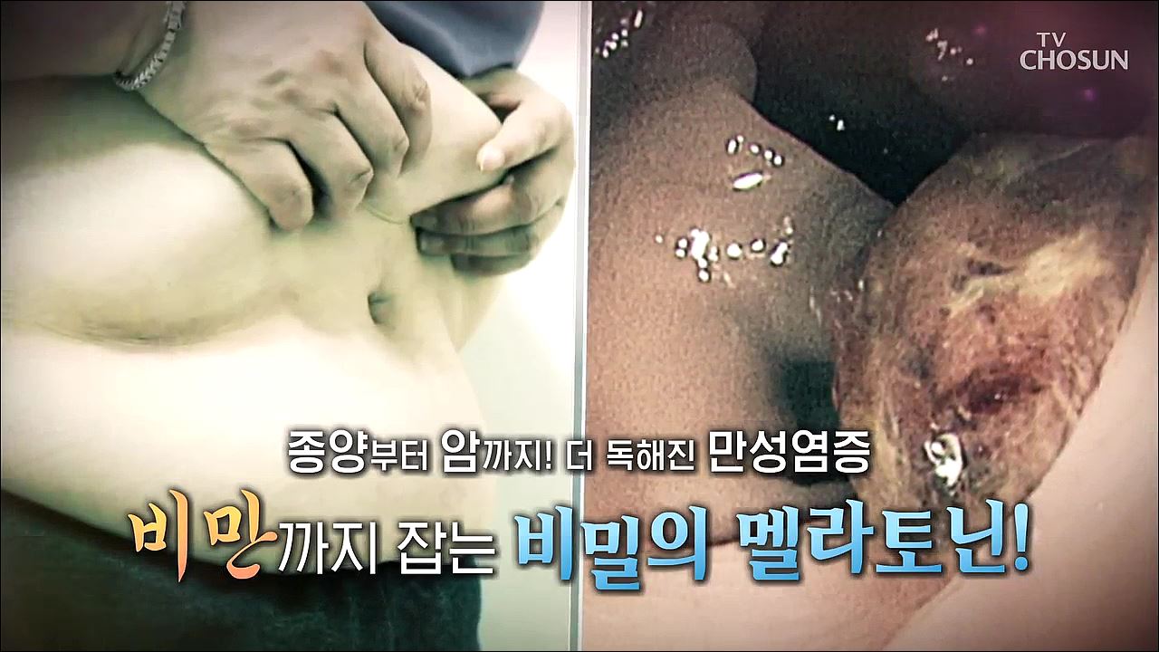 백세시대 프로젝트 위대한 유산 80회