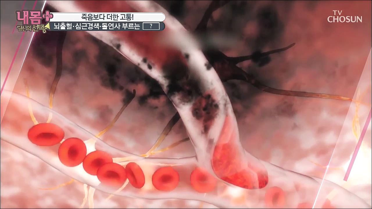 내 몸 플러스 199회