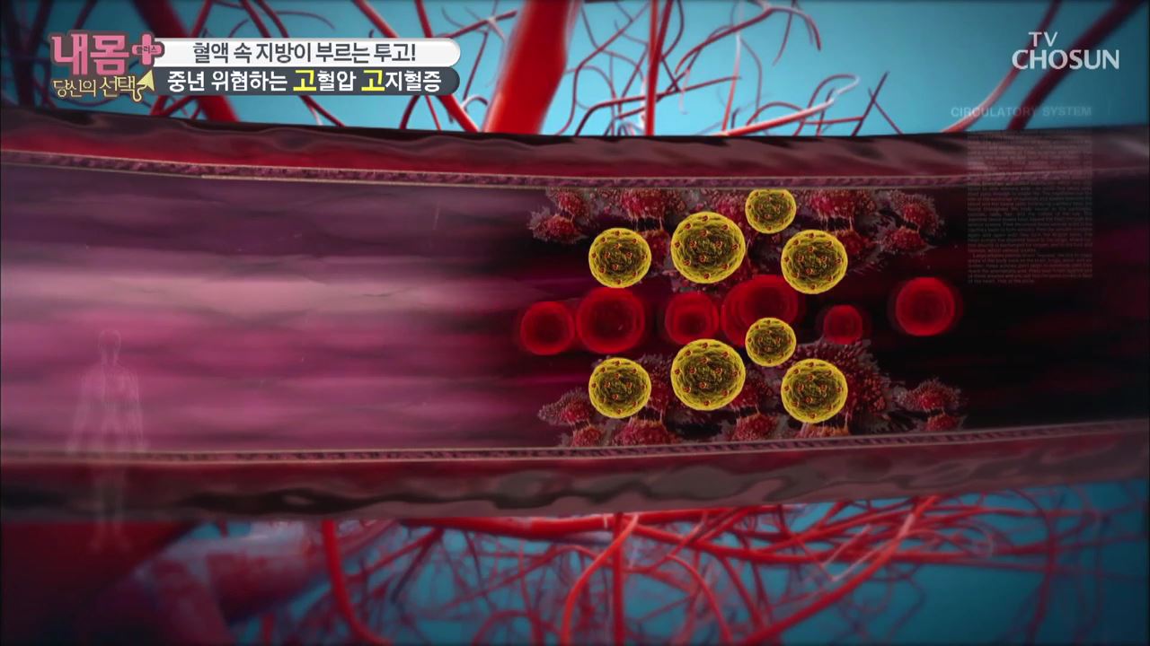 내 몸 플러스 200회