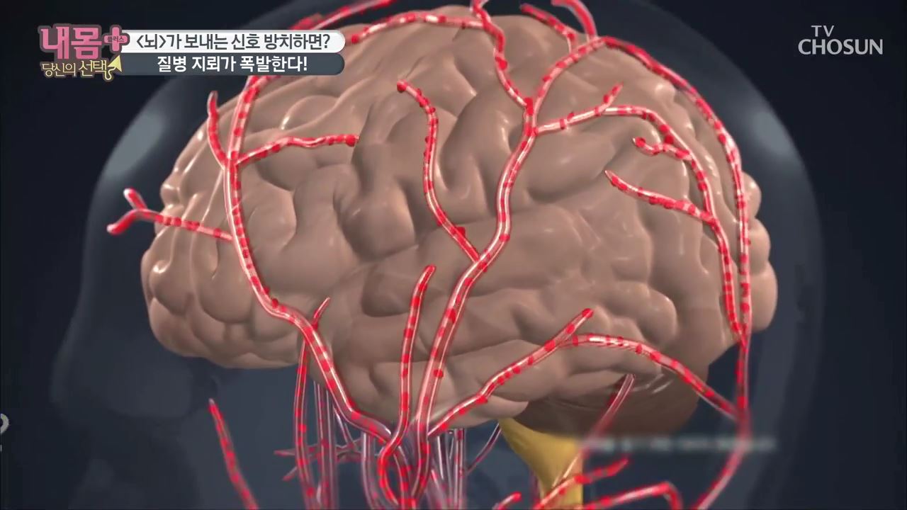 내 몸 플러스 203회