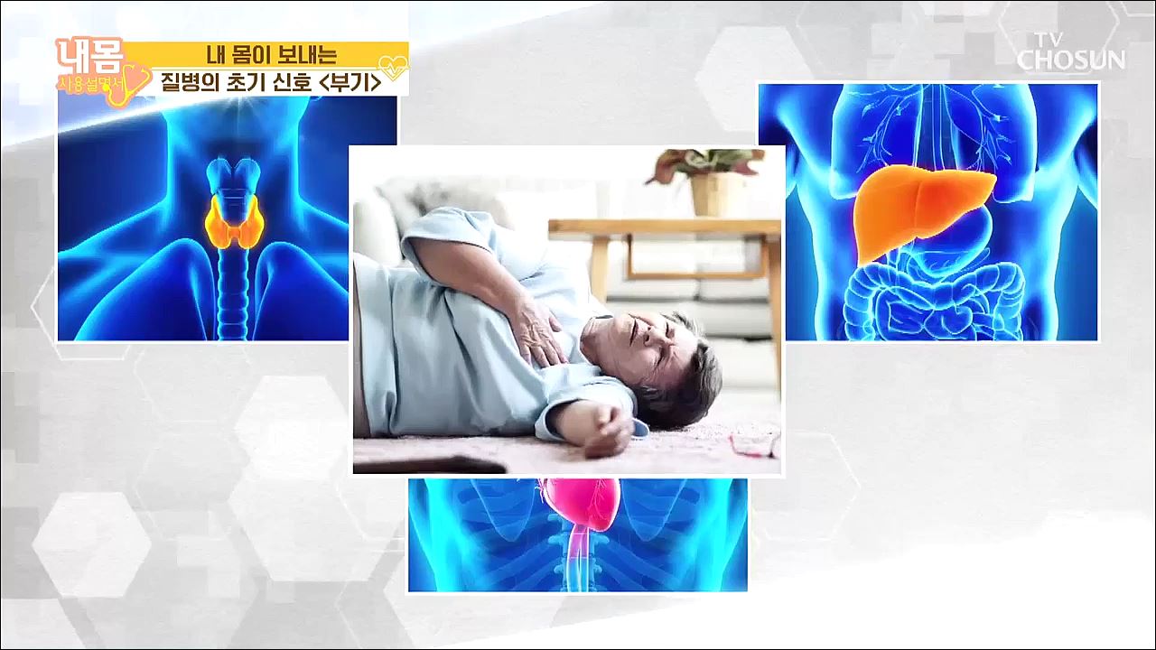 내 몸 사용 설명서 309회