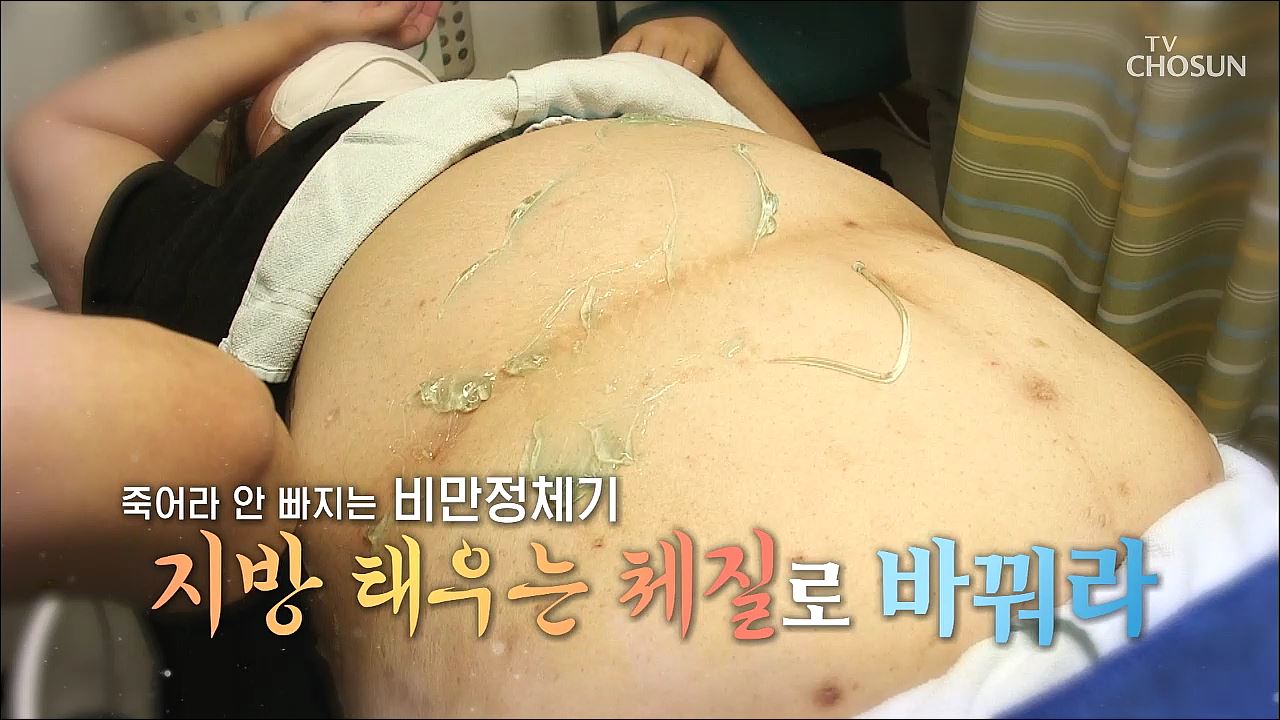 백세시대 프로젝트 위대한 유산 87회