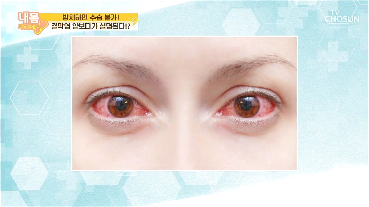 내 몸 사용 설명서 310회