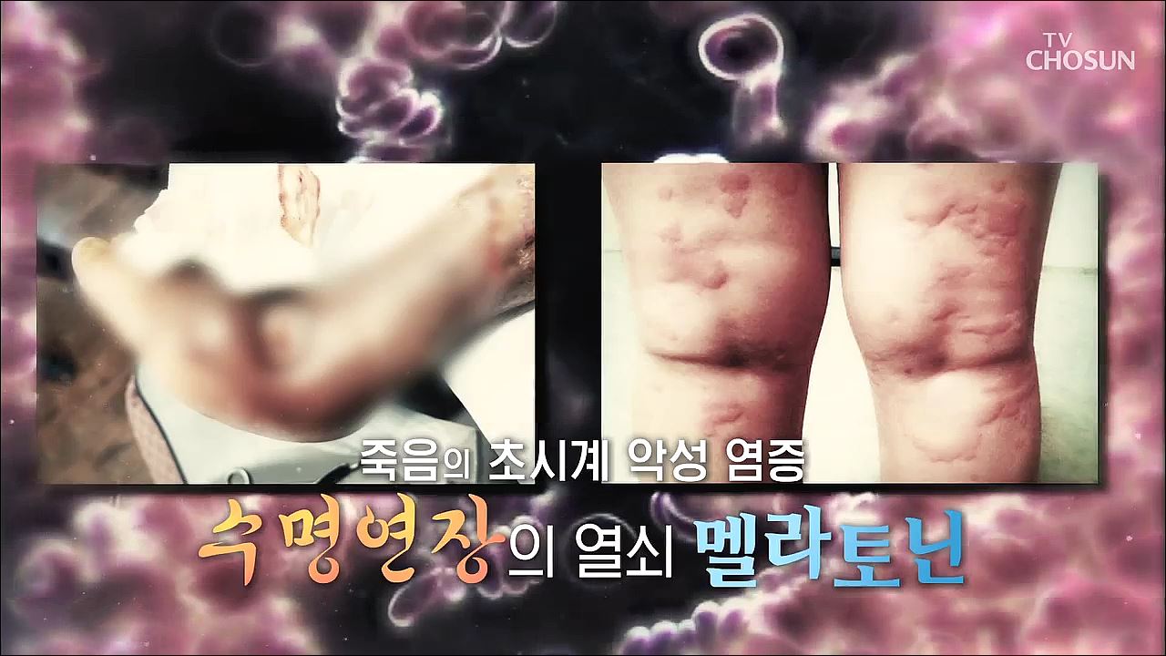 백세시대 프로젝트 위대한 유산 88회