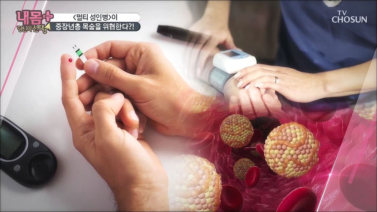 내 몸 플러스 209회