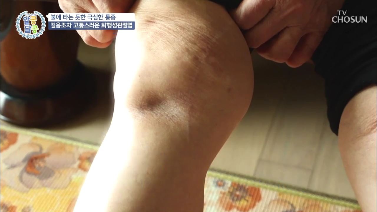알콩달콩 47회