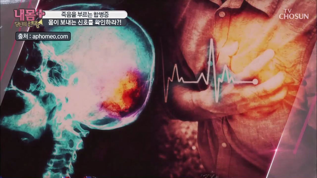 내 몸 플러스 213회