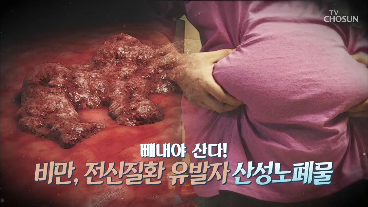건강다큐 107회 - 비만, 전신질환 유발자 산성노폐물