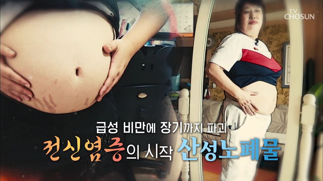 백세시대 프로젝트 위대한 유산 102회