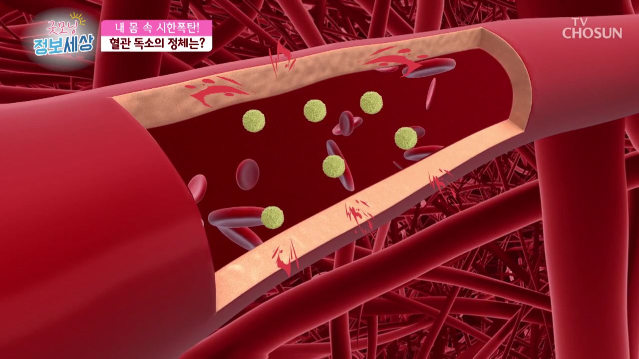 굿모닝 정보세상 314회