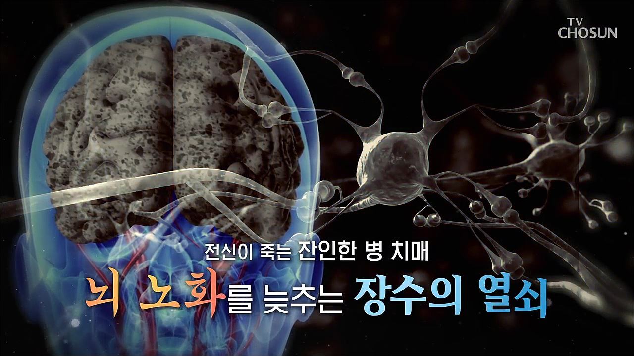백세시대 프로젝트 위대한 유산 118회