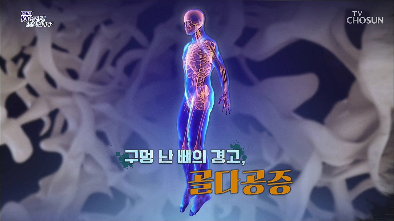 건강다큐 186회 - 구멍 난 뼈의 경고, 골다공증