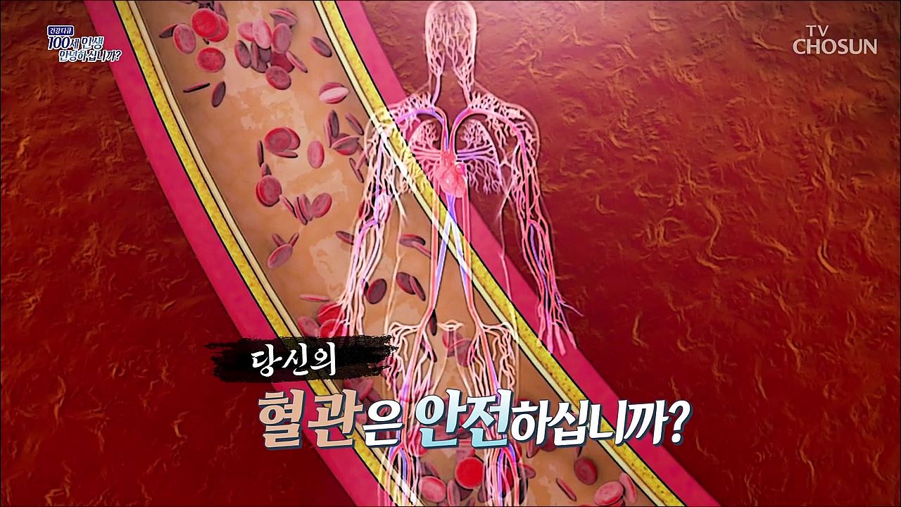 건강다큐 201회 - 당신의 혈관은 안전하십니까?