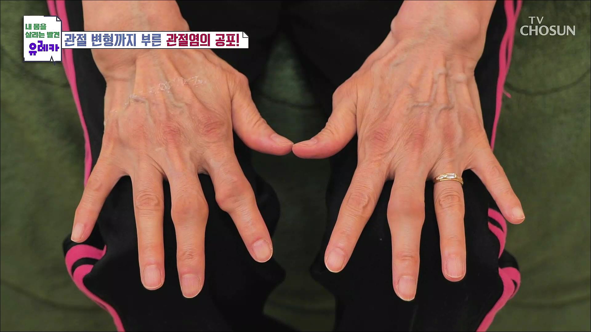 내 몸을 살리는 발견 유레카 112회