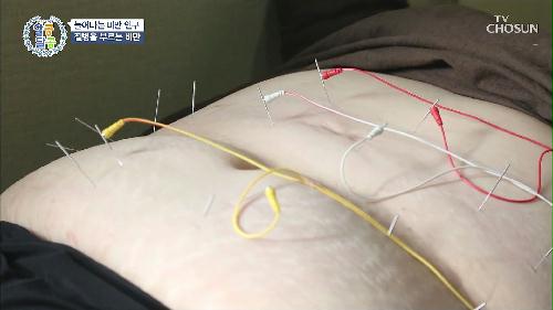 알콩달콩 198회