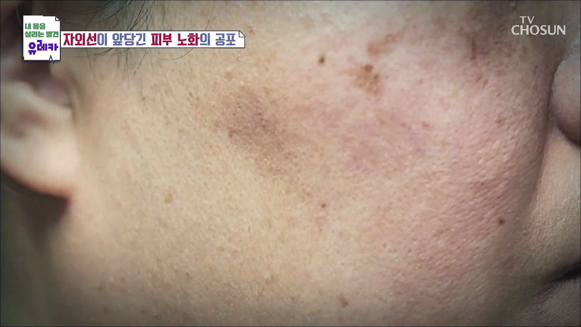 내 몸을 살리는 발견 유레카 136회