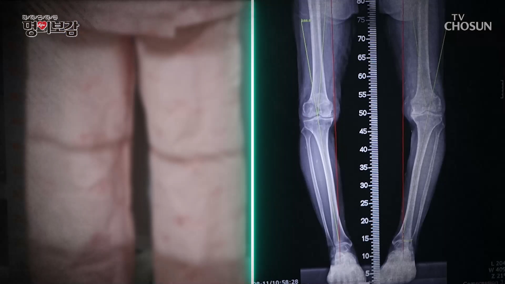 메디컬다큐 명의보감 114회