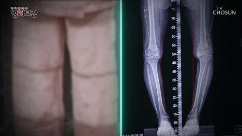 메디컬다큐 명의보감 114회