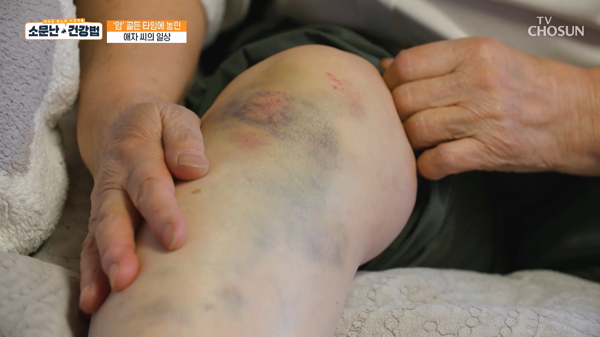 소문난 건강법 108회