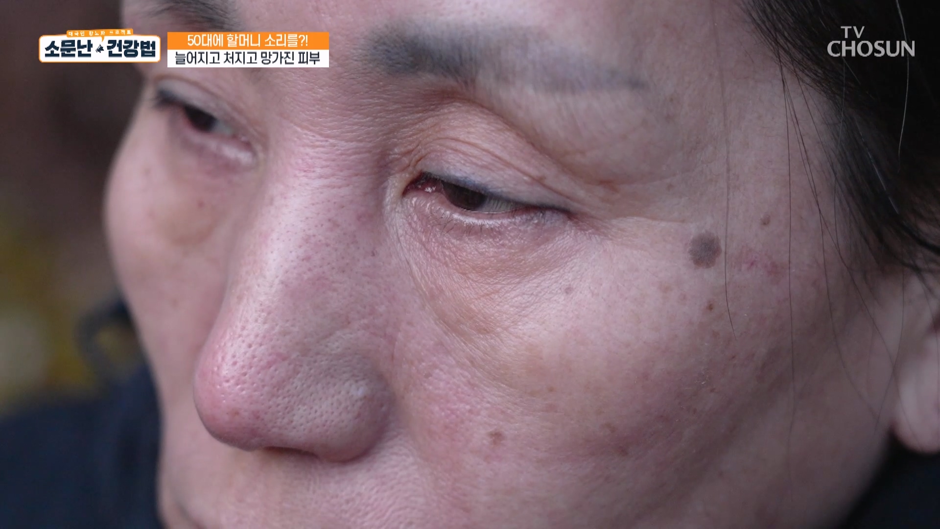 소문난 건강법 115회