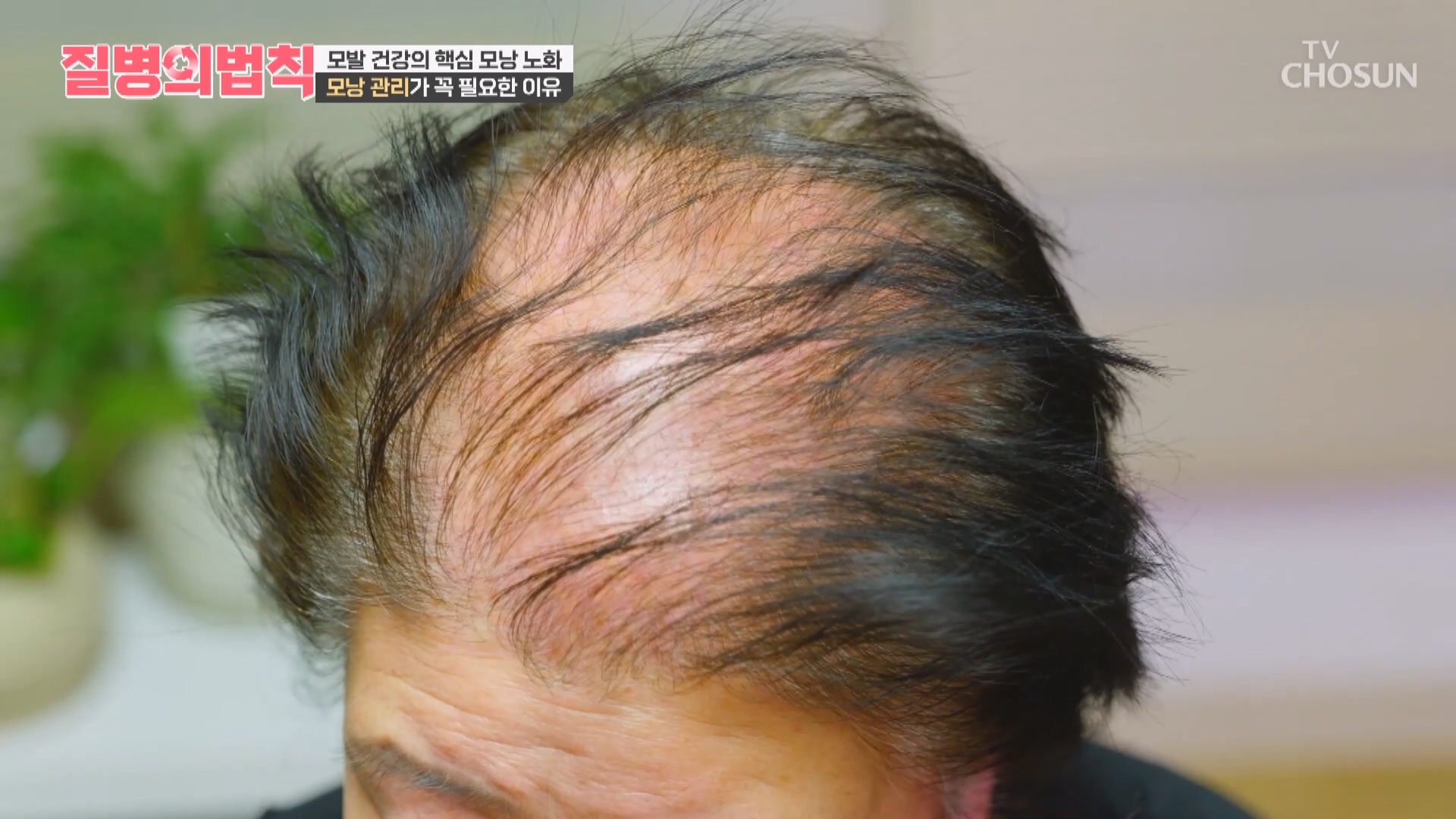 질병의 법칙 98회