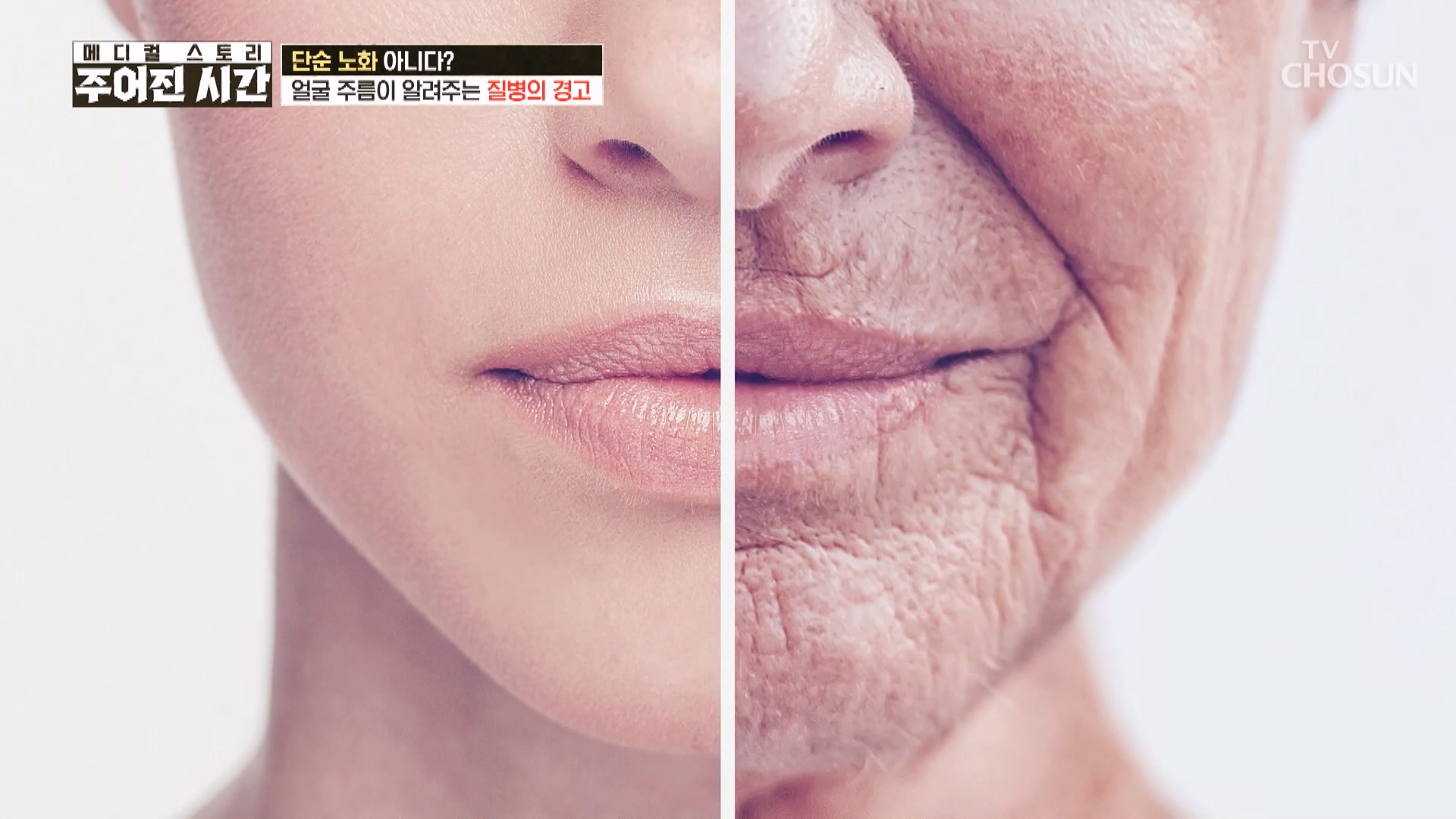 메디컬 스토리 주어진 시간 13회