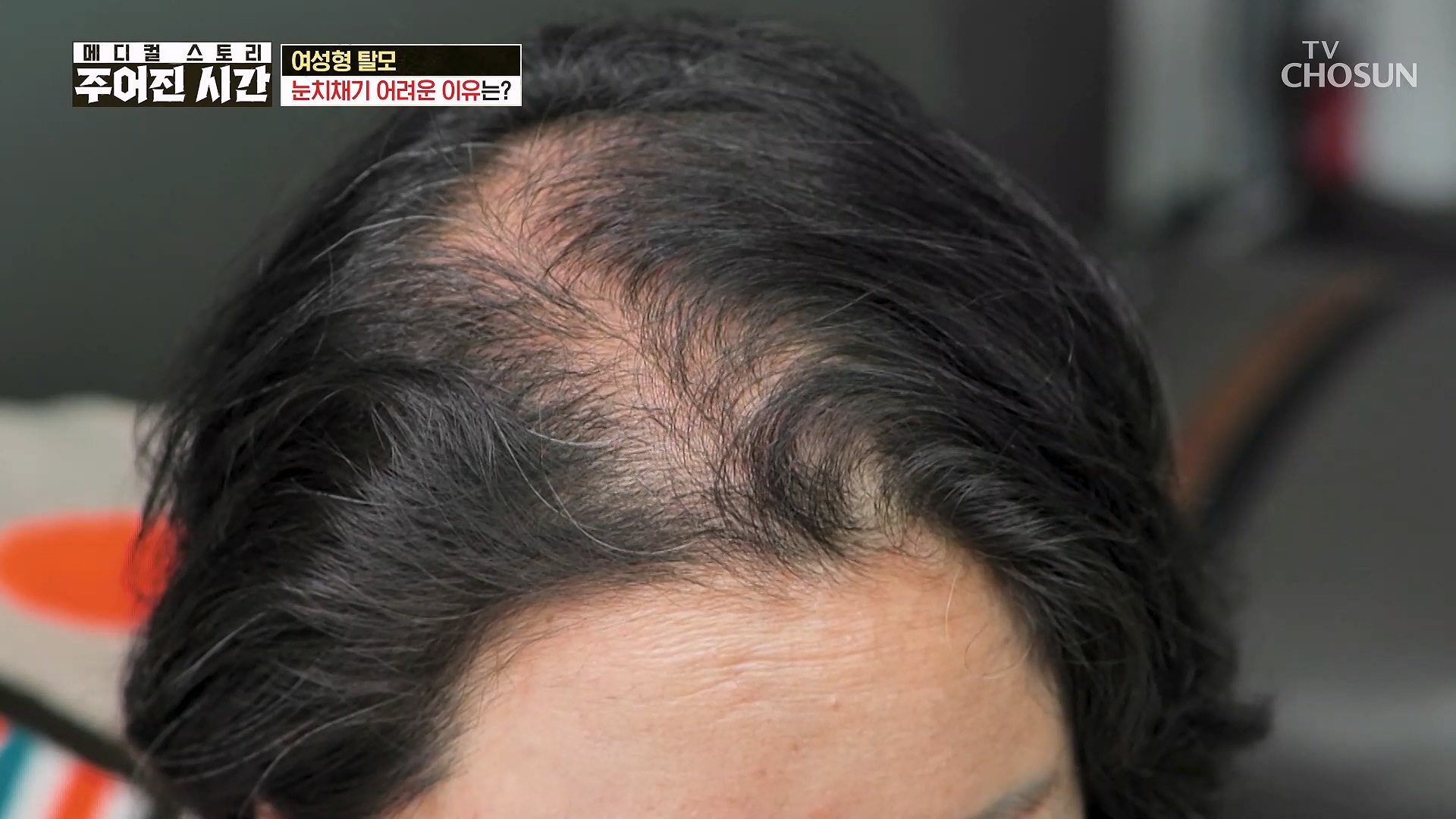 메디컬 스토리 주어진 시간 15회