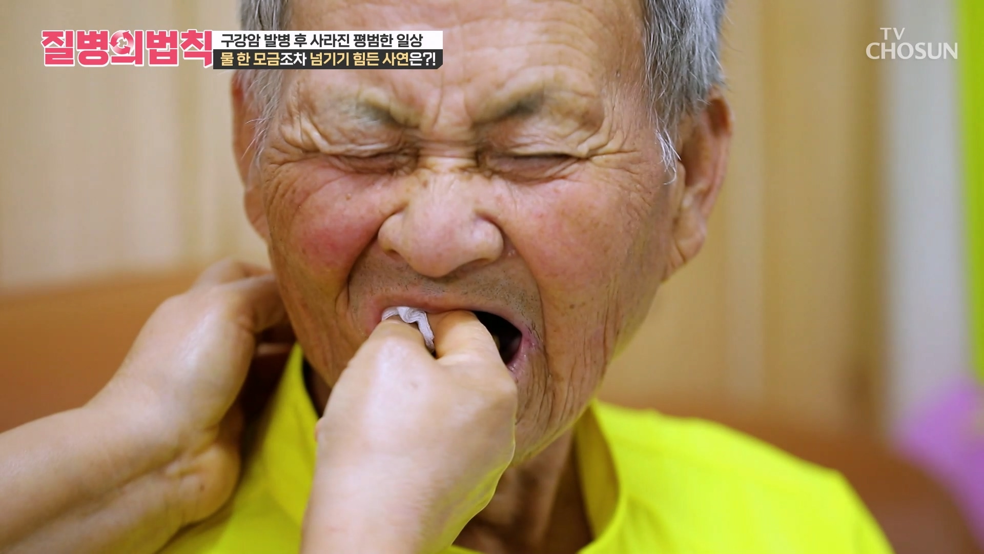 질병의 법칙 104회