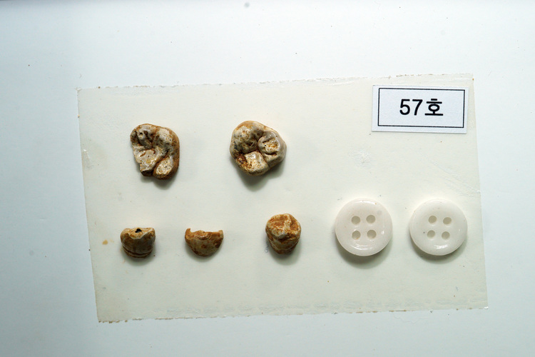 발굴된 치아와 단추 /진실화해위 제공