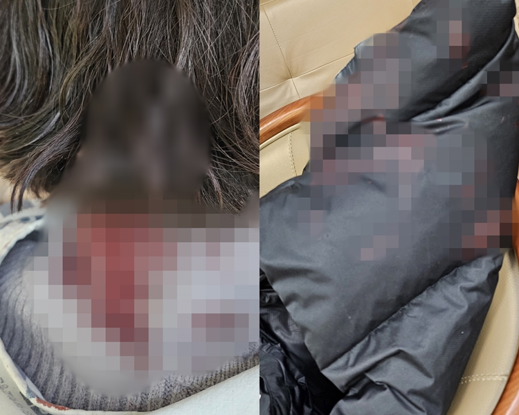 배현진 의원 피습 직후 촬영된 사진. /배현진 의원실 제공