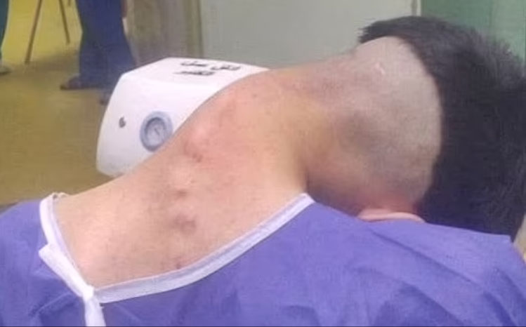 오랜 마약 복용으로 목이 꺾인 이란 남성 /출처 : 데일리메일