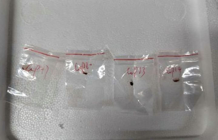 중국인 연구원들이 미국으로 밀반입하려 한 푸자리움 그라미네아룸(Fusarium graminearum) 병원균 샘플. /사우스차이나모닝포스트 홈페이지 캡처
